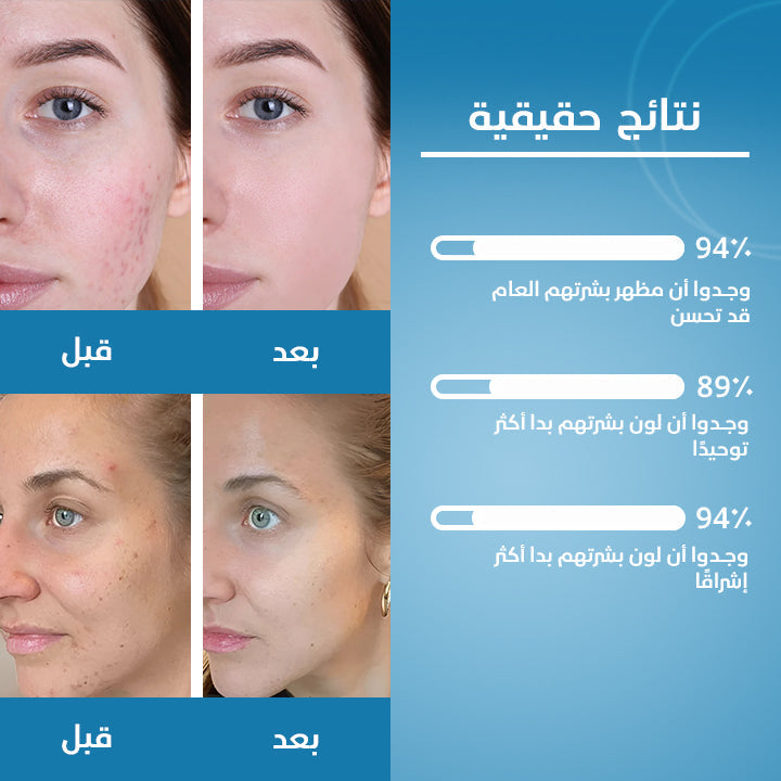 الكركم وحمض الكوجيك
