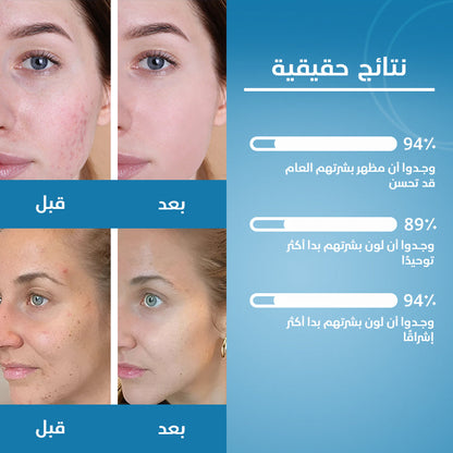 الكركم وحمض الكوجيك